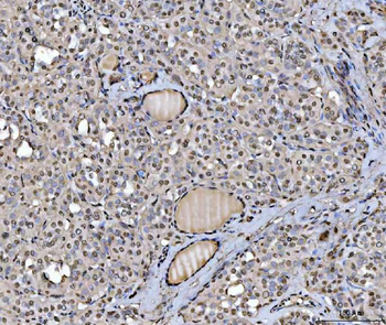 hnRNP U/p120/HNRNPU Rabbit Polyclonal Antibody