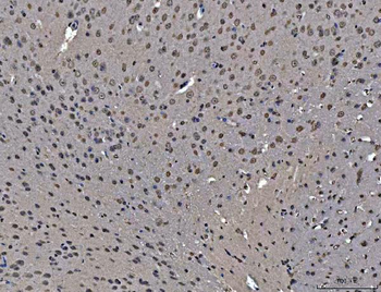 hnRNP U/p120/HNRNPU Rabbit Polyclonal Antibody
