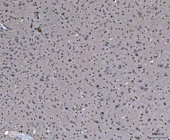 hnRNP U/p120/HNRNPU Rabbit Polyclonal Antibody