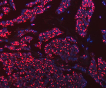 hnRNP U/p120/HNRNPU Rabbit Polyclonal Antibody