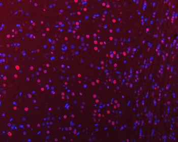 hnRNP U/p120/HNRNPU Rabbit Polyclonal Antibody