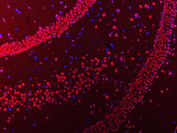 hnRNP U/p120/HNRNPU Rabbit Polyclonal Antibody