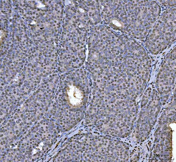 hnRNP U/p120/HNRNPU Rabbit Polyclonal Antibody