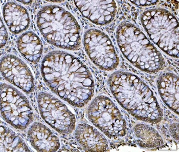 hnRNP U/p120/HNRNPU Rabbit Polyclonal Antibody