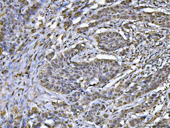 hnRNP U/p120/HNRNPU Rabbit Polyclonal Antibody