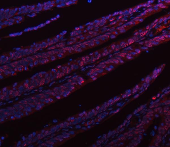hnRNP L/HNRNPL Rabbit Polyclonal Antibody