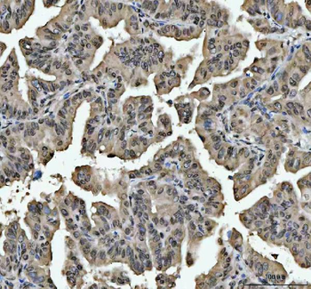 hnRNP L/HNRNPL Rabbit Polyclonal Antibody