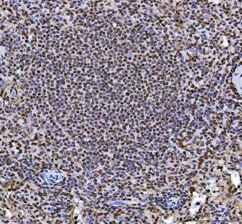 hnRNP L/HNRNPL Rabbit Polyclonal Antibody