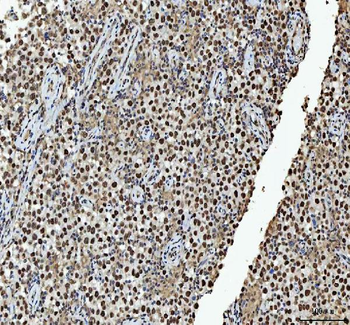hnRNP L/HNRNPL Rabbit Polyclonal Antibody