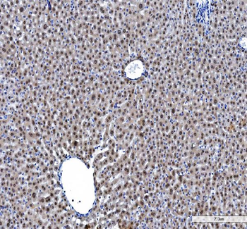 hnRNP L/HNRNPL Rabbit Polyclonal Antibody