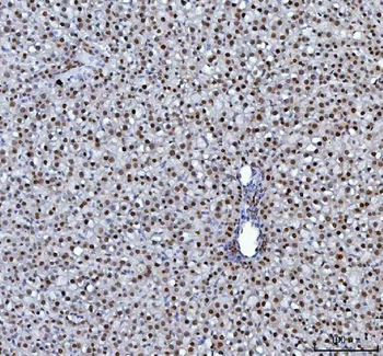hnRNP L/HNRNPL Rabbit Polyclonal Antibody