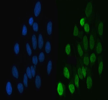 hnRNP L/HNRNPL Rabbit Polyclonal Antibody