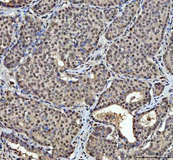 hnRNP L/HNRNPL Rabbit Polyclonal Antibody