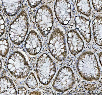 hnRNP L/HNRNPL Rabbit Polyclonal Antibody