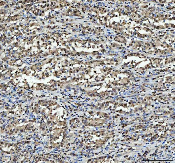 hnRNP L/HNRNPL Rabbit Polyclonal Antibody