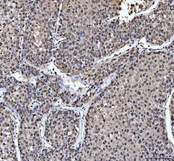 hnRNP L/HNRNPL Rabbit Polyclonal Antibody