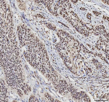 hnRNP L/HNRNPL Rabbit Polyclonal Antibody