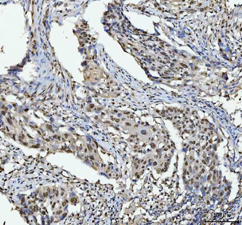 hnRNP L/HNRNPL Rabbit Polyclonal Antibody