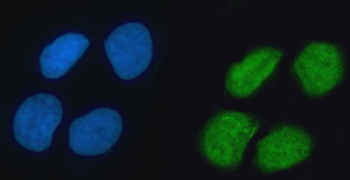 hnRNP K/HNRNPK Rabbit Polyclonal Antibody