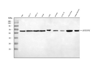 hnRNP K/HNRNPK Rabbit Polyclonal Antibody