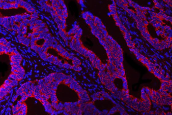 DTR/HBEGF Rabbit Polyclonal Antibody