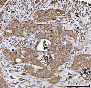 DTR/HBEGF Rabbit Polyclonal Antibody