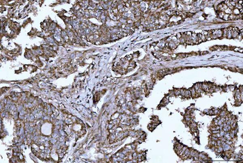 DTR/HBEGF Rabbit Polyclonal Antibody