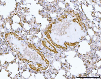 DTR/HBEGF Rabbit Polyclonal Antibody