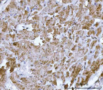 DTR/HBEGF Rabbit Polyclonal Antibody