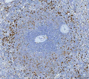 Granzyme K/GZMK Rabbit Polyclonal Antibody