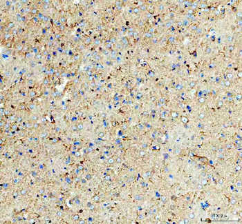 GSK3 beta/GSK3B Rabbit Polyclonal Antibody