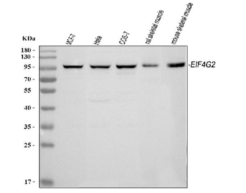 P97/DAP5/EIF4G2 Rabbit Polyclonal Antibody
