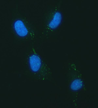 YKL-40/CHI3L1/YKL Rabbit Polyclonal Antibody