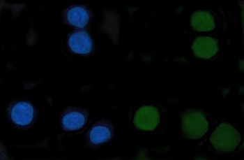 CENPF Rabbit Polyclonal Antibody