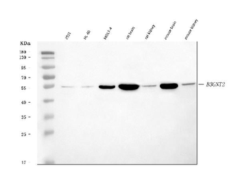 B3GNT2 Rabbit Polyclonal Antibody