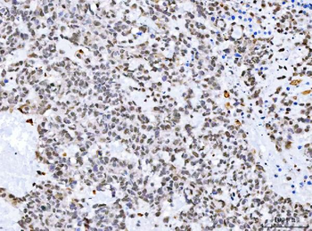 Aurora A/AURKA Rabbit Polyclonal Antibody