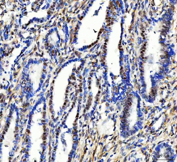 Aurora A/AURKA Rabbit Polyclonal Antibody
