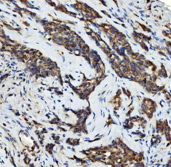 Aurora A/AURKA Rabbit Polyclonal Antibody