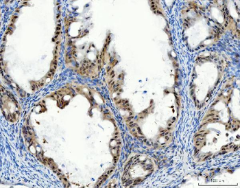 Aurora A/AURKA Rabbit Polyclonal Antibody