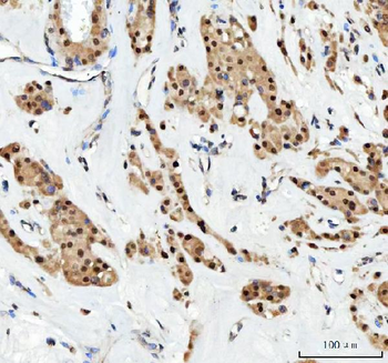 Aurora A/AURKA Rabbit Polyclonal Antibody