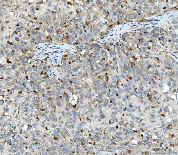 Aurora A/AURKA Rabbit Polyclonal Antibody