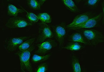 ARL13B Rabbit Polyclonal Antibody