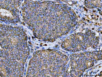 ARL13B Rabbit Polyclonal Antibody