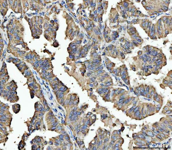 ARL13B Rabbit Polyclonal Antibody