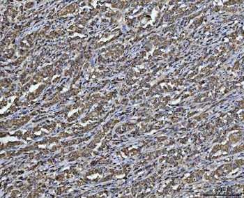 ARL13B Rabbit Polyclonal Antibody