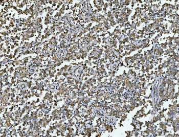 ARL13B Rabbit Polyclonal Antibody