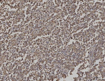 ARL13B Rabbit Polyclonal Antibody