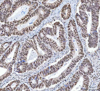 XRCC4 Rabbit Polyclonal Antibody