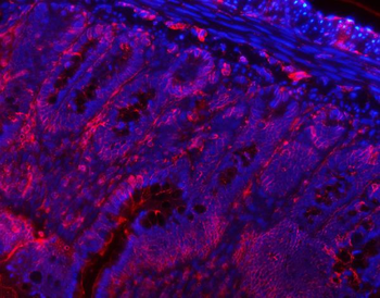 VAPA Rabbit Polyclonal Antibody