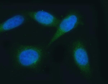 VAPA Rabbit Polyclonal Antibody